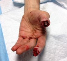 Microcirugia02