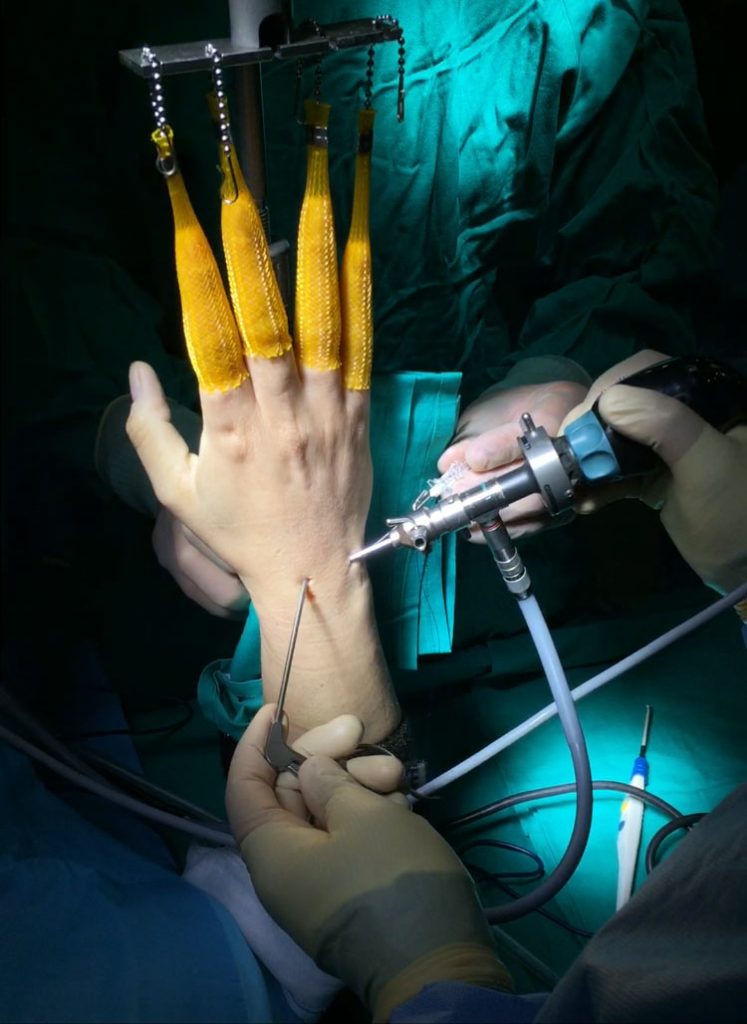 Foto ilustración especialidad ARTROSCOPIA copia